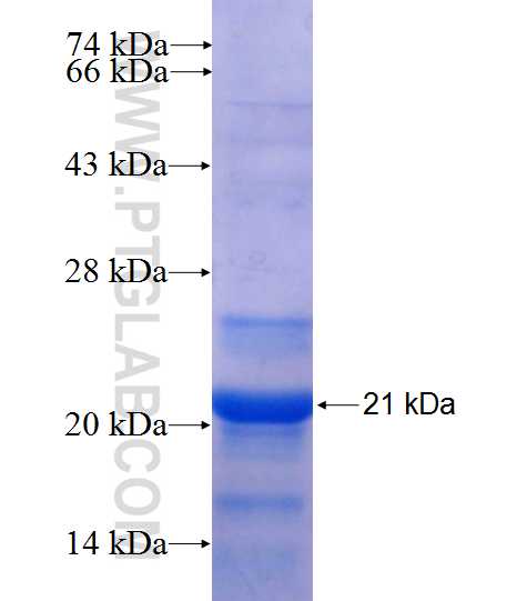 FOXB1 fusion protein Ag18079 SDS-PAGE