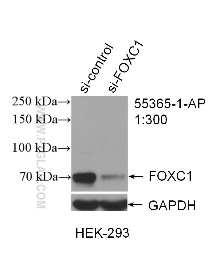 Western Blot (WB) analysis of HEK-293 cells using FOXC1 Polyclonal antibody (55365-1-AP)