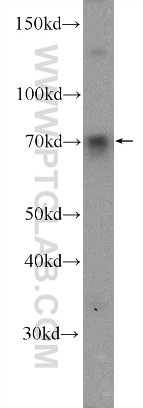 Western Blot (WB) analysis of HEK-293 cells using FOXC1 Polyclonal antibody (55365-1-AP)