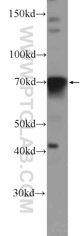 Western Blot (WB) analysis of HEK-293 cells using FOXC1 Polyclonal antibody (55365-1-AP)