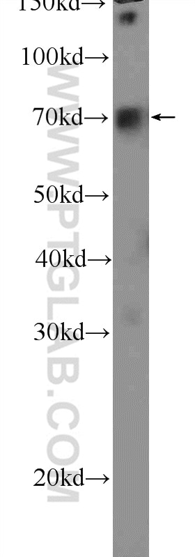 Western Blot (WB) analysis of HepG2 cells using FOXC1 Polyclonal antibody (55365-1-AP)