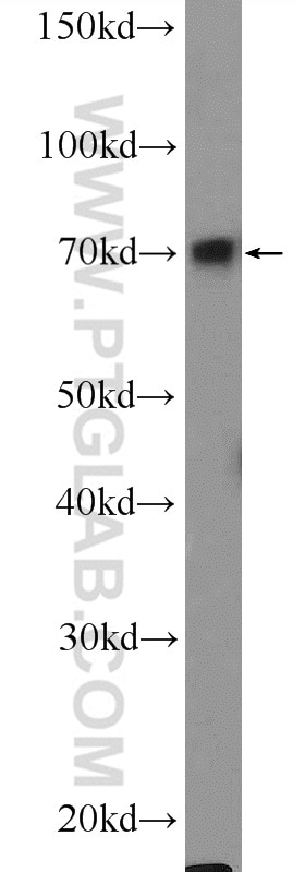 Western Blot (WB) analysis of MCF-7 cells using FOXC1 Polyclonal antibody (55365-1-AP)