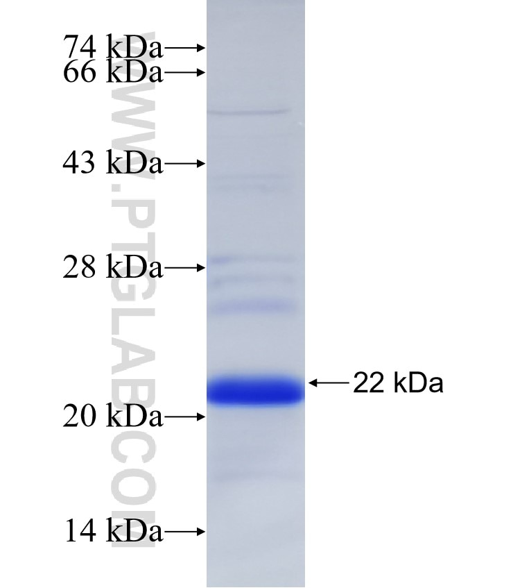 FOXC1 fusion protein Ag32531 SDS-PAGE