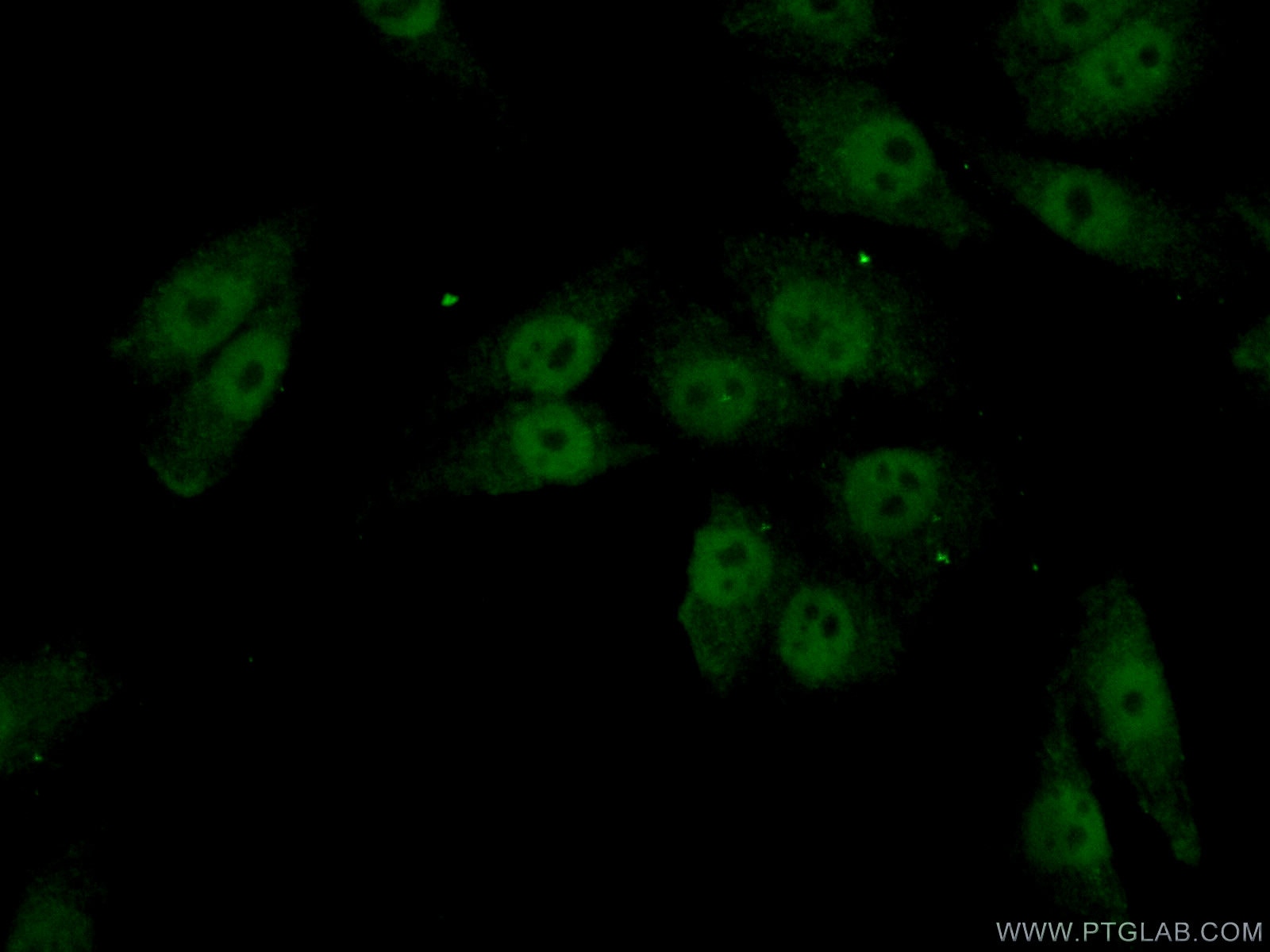 Immunofluorescence (IF) / fluorescent staining of A375 cells using FOXC2 Polyclonal antibody (23066-1-AP)