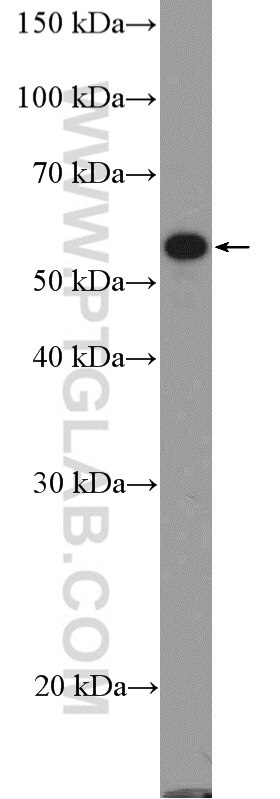 Western Blot (WB) analysis of A375 cells using FOXC2 Polyclonal antibody (23066-1-AP)