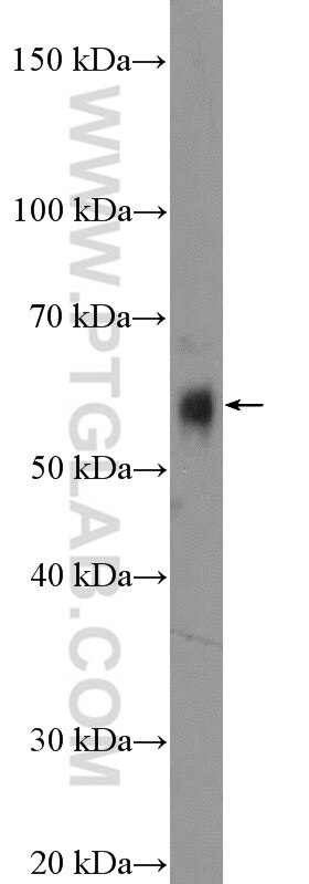 Western Blot (WB) analysis of rat spleen tissue using FOXC2 Polyclonal antibody (23066-1-AP)