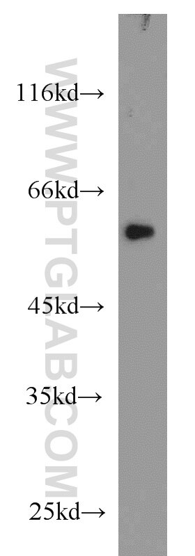 Western Blot (WB) analysis of A431 cells using FOXC2 Polyclonal antibody (23066-1-AP)