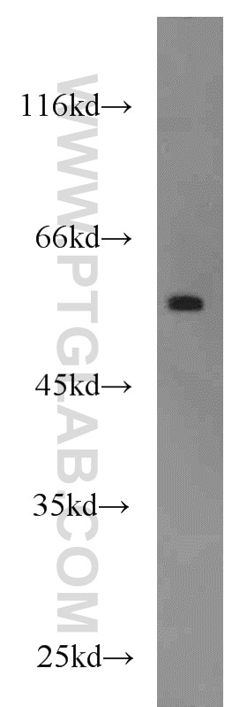 Western Blot (WB) analysis of A375 cells using FOXC2 Polyclonal antibody (23066-1-AP)