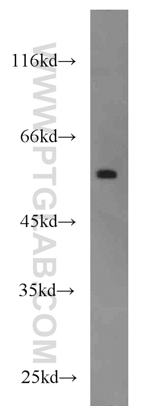 FOXC2 Polyclonal antibody