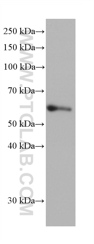 Western Blot (WB) analysis of hTERT-RPE1 cells using FOXC2 Monoclonal antibody (68384-1-Ig)
