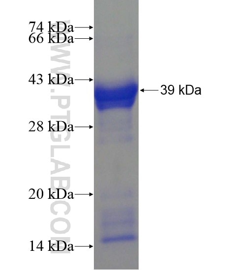 FOXC2 fusion protein Ag19378 SDS-PAGE