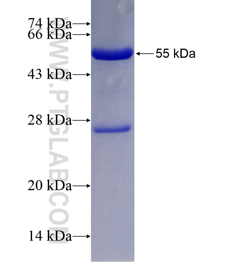 FOXD1 fusion protein Ag29344 SDS-PAGE