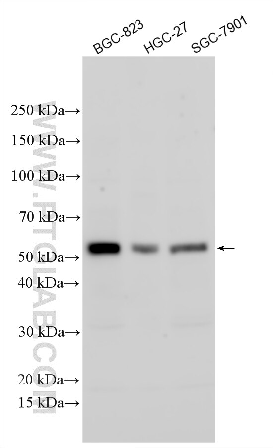 Western Blot (WB) analysis of various lysates using FOXD2 Polyclonal antibody (34275-1-AP)