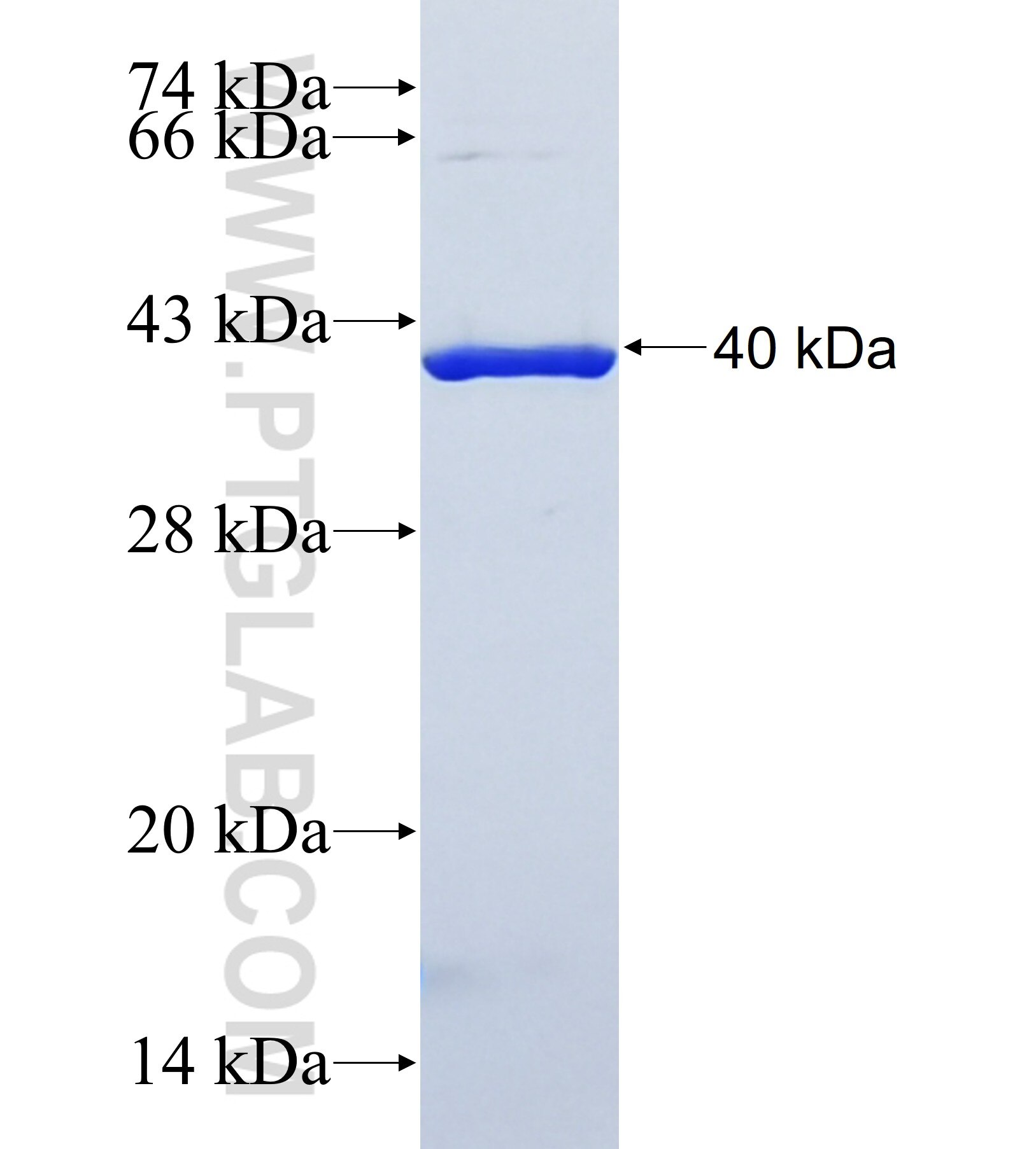 FOXD2 fusion protein Ag41978 SDS-PAGE FOXD2 fusion protein Ag41978 SDS-PAGE