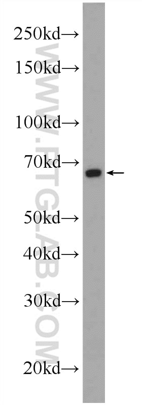 Western Blot (WB) analysis of RAW 264.7 cells using FOXD4 Polyclonal antibody (24835-1-AP)