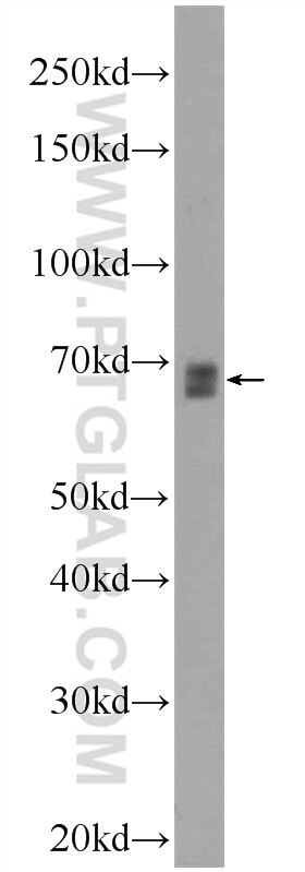 Western Blot (WB) analysis of U-937 cells using FOXD4 Polyclonal antibody (24835-1-AP)