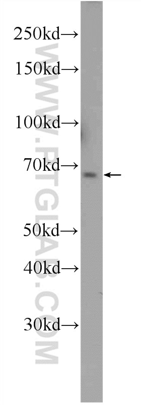 Western Blot (WB) analysis of Jurkat cells using FOXD4 Polyclonal antibody (24835-1-AP)