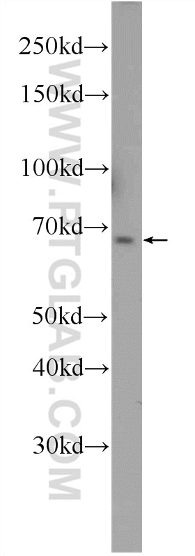 WB analysis of Jurkat using 24835-1-AP