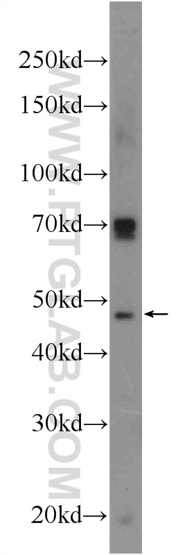 Western Blot (WB) analysis of HepG2 cells using FOXD4L6 Polyclonal antibody (22081-1-AP)