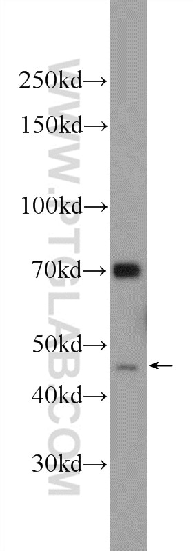 Western Blot (WB) analysis of Jurkat cells using FOXD4L6 Polyclonal antibody (22081-1-AP)