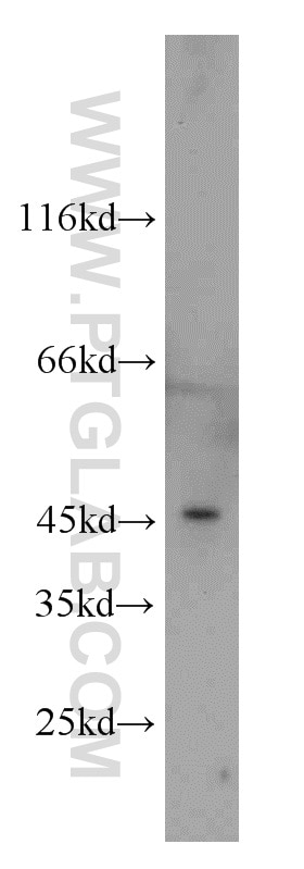 Western Blot (WB) analysis of A431 cells using FOXD4L6 Polyclonal antibody (22081-1-AP)