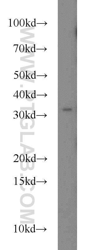 WB analysis of HepG2 using 55301-1-AP