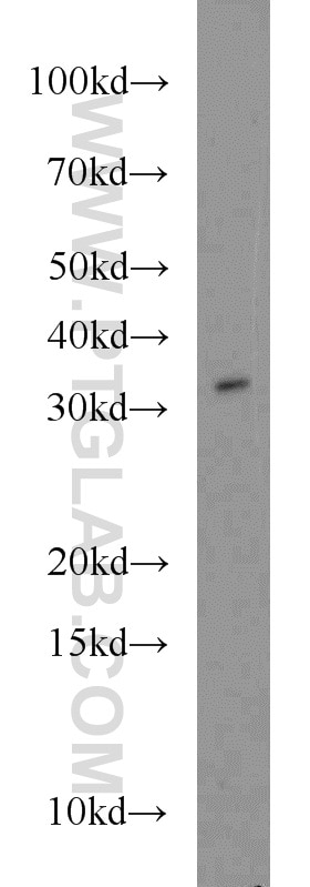 Western Blot (WB) analysis of A375 cells using FOXE3 Polyclonal antibody (55301-1-AP)