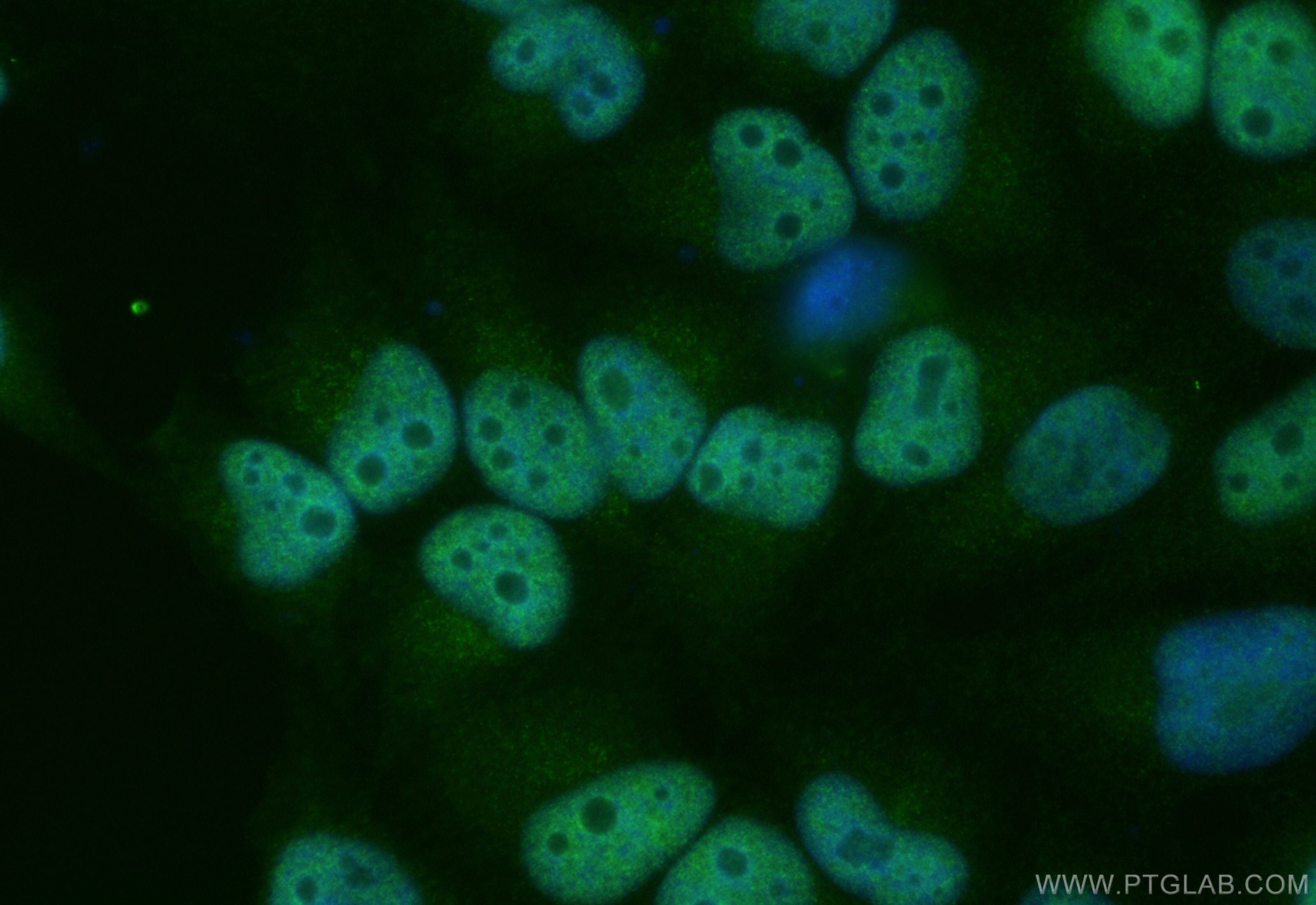 Immunofluorescence (IF) / fluorescent staining of HeLa cells using CoraLite® Plus 488-conjugated FOXF1 Recombinant an (CL488-84020-3)