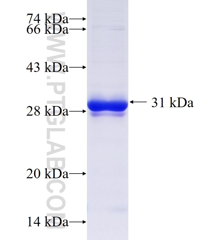 FOXF1 fusion protein Ag34908 SDS-PAGE FOXF1 fusion protein Ag34908 SDS-PAGE