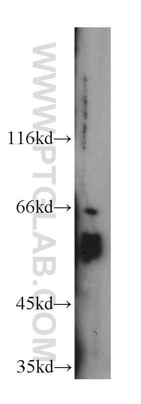 Western Blot (WB) analysis of SH-SY5Y cells using FOXG1 Polyclonal antibody (12764-1-AP)