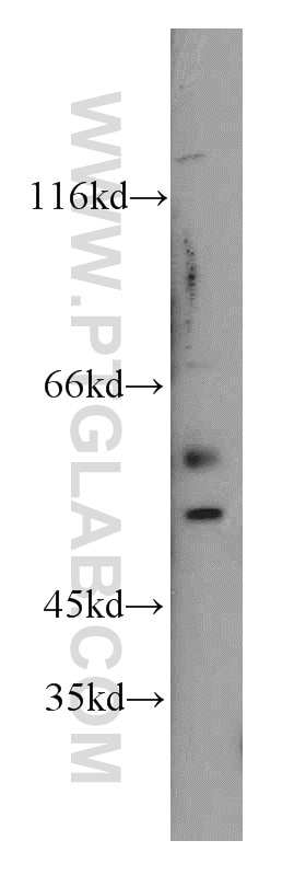 Western Blot (WB) analysis of mouse brain tissue using FOXG1 Polyclonal antibody (12764-1-AP)