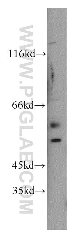 WB analysis of mouse brain using 12764-1-AP