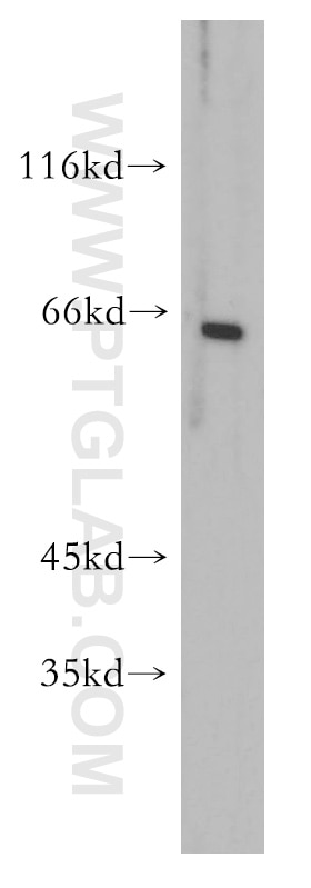 Western Blot (WB) analysis of mouse testis tissue using FOXG1 Polyclonal antibody (12764-1-AP)