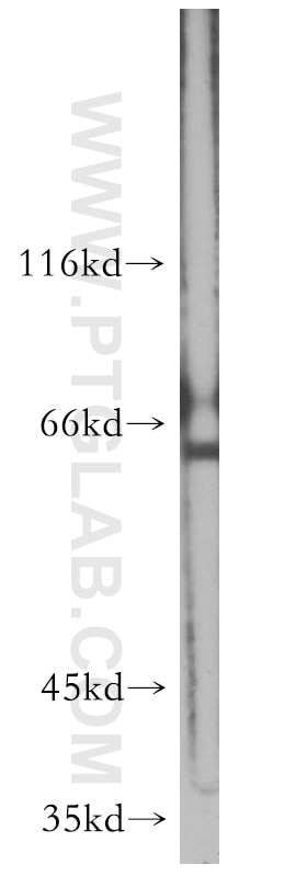 Western Blot (WB) analysis of mouse brain tissue using FOXG1 Polyclonal antibody (12764-1-AP)