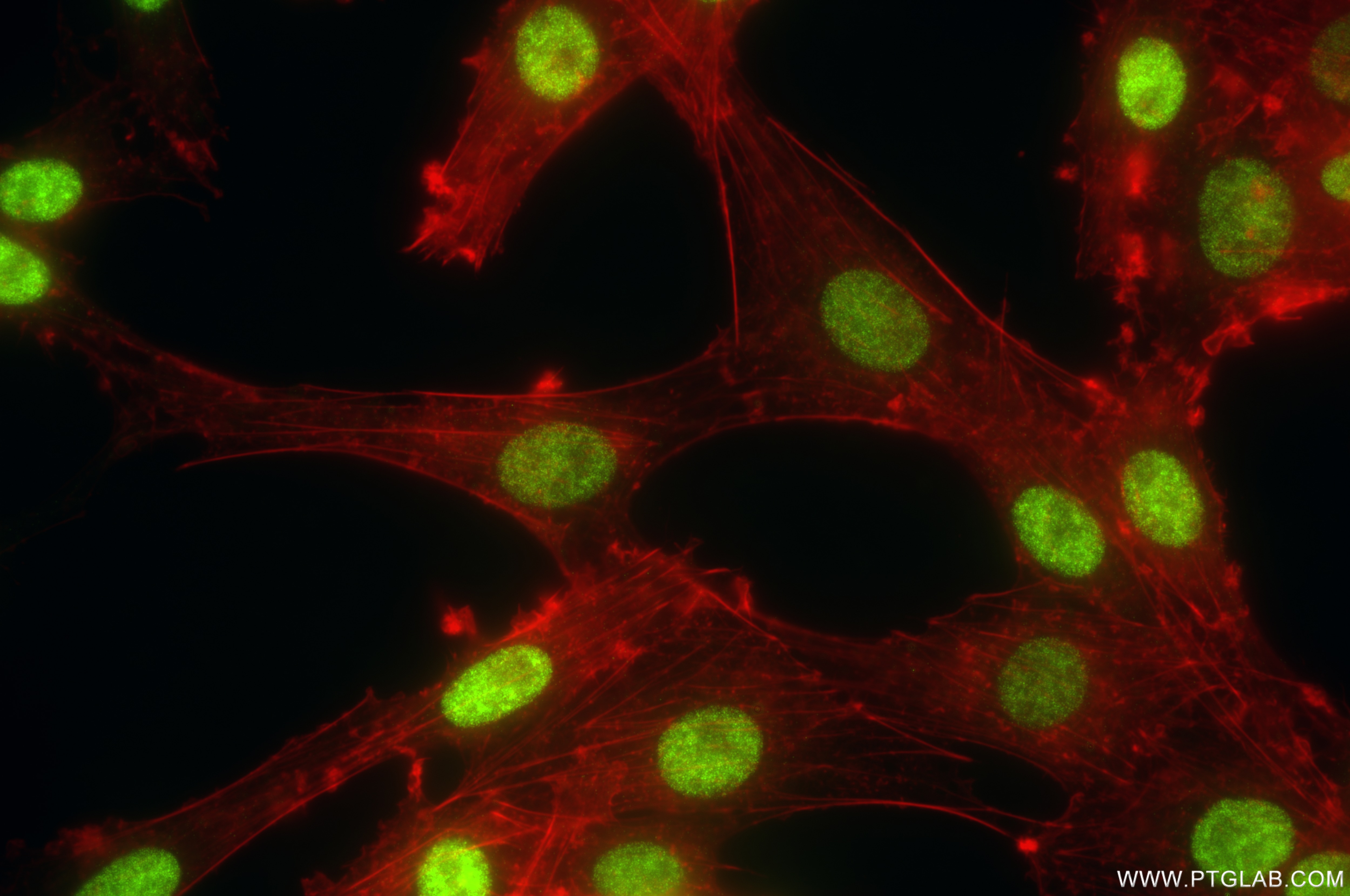 Immunofluorescence (IF) / fluorescent staining of C6 cells using FOXG1 Recombinant antibody (85930-1-RR)
