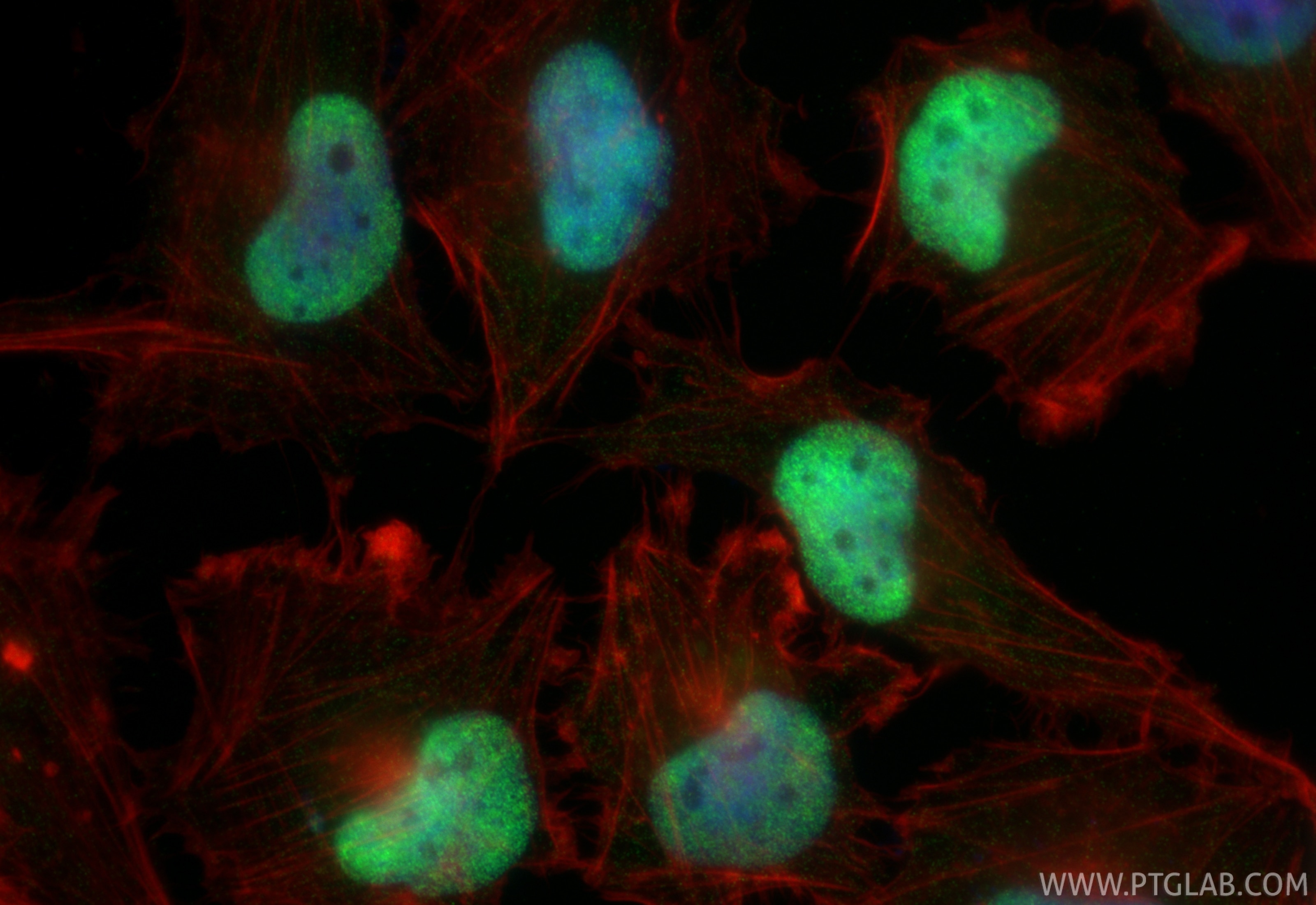 Immunofluorescence (IF) / fluorescent staining of U-251 cells using FOXG1 Recombinant monoclonal antibody (85930-1-RR)