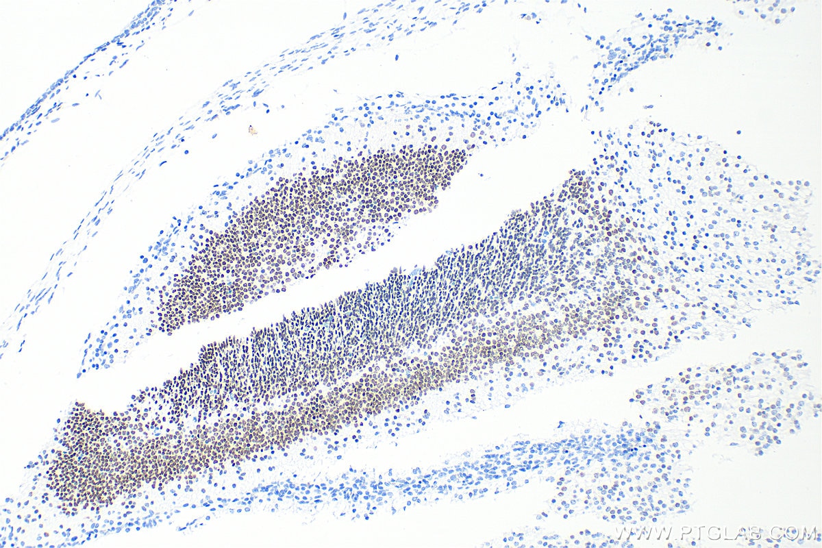 Immunohistochemistry (IHC) staining of mouse embryo tissue using FOXG1 Recombinant monoclonal antibody (85930-1-RR)