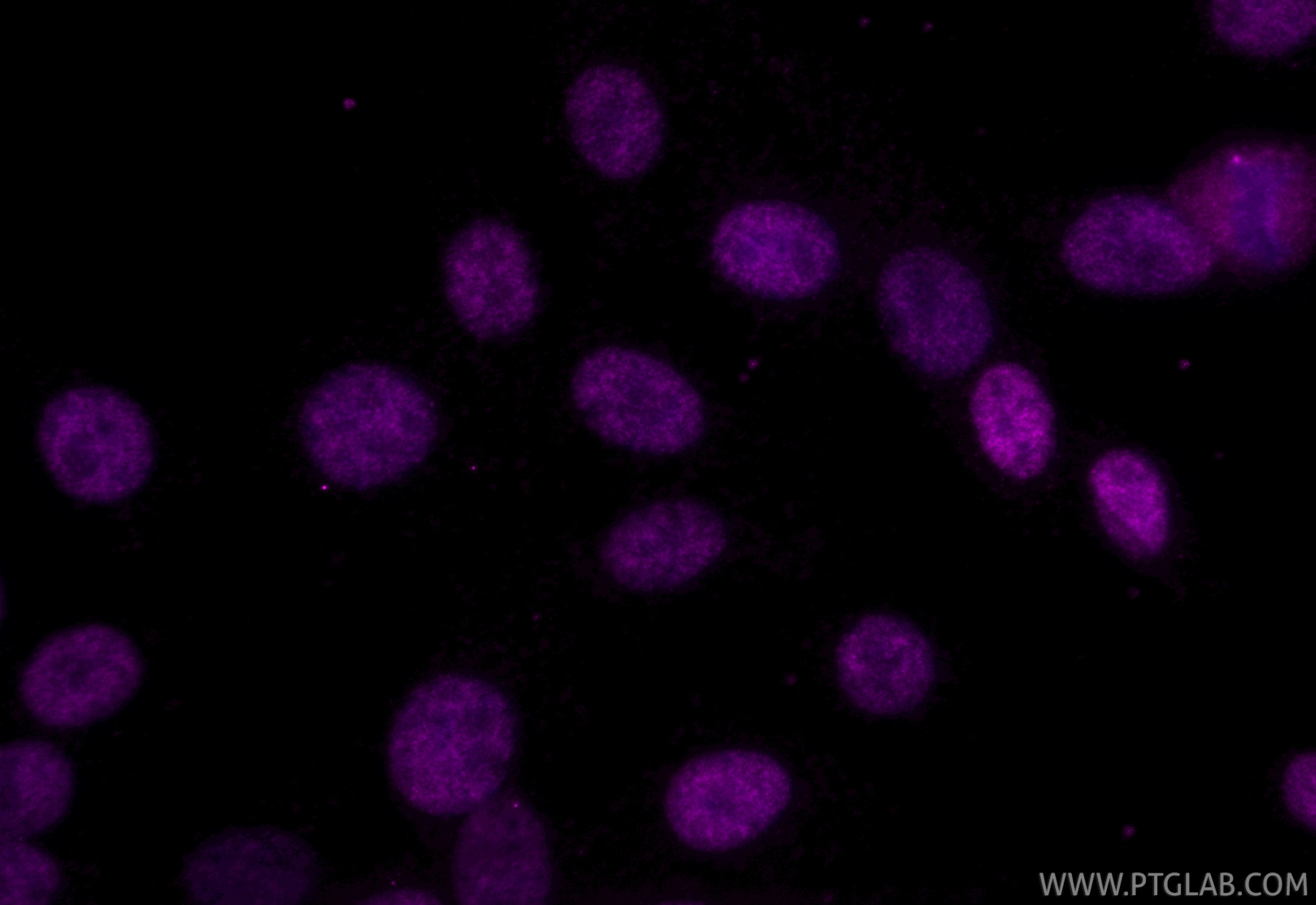Immunofluorescent analysis of (4% PFA) fixed C6 cells using CoraLite® Plus 647 FOXG1 antibody (CL647-85930, Clone: 250144E8 ) at dilution of 1:200. Immunofluorescence (IF) / fluorescent staining of C6 cells using CoraLite® Plus 647-conjugated FOXG1 Recombinant mo (CL647-85930)