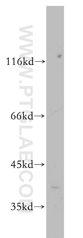 Western Blot (WB) analysis of mouse liver tissue using FOXH1-Specific Polyclonal antibody (20268-1-AP)