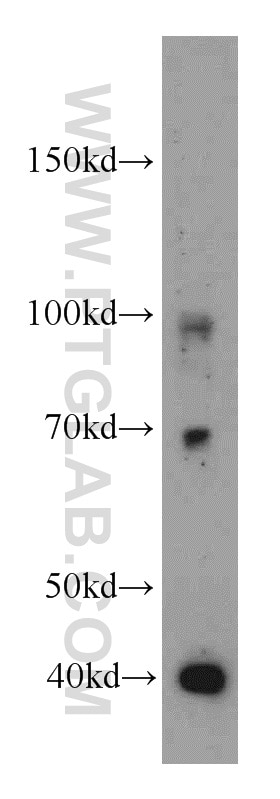 Western Blot (WB) analysis of L02 cells using FOXH1-Specific Polyclonal antibody (20268-1-AP)