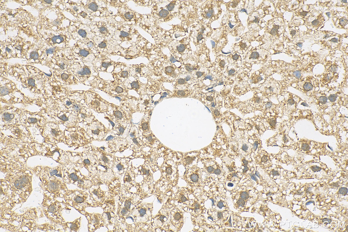 Immunohistochemistry (IHC) staining of mouse liver tissue using FOXJ1 Polyclonal antibody (25903-1-AP)