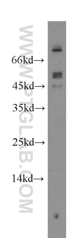 Western Blot (WB) analysis of HEK-293 cells using FOXJ3 Polyclonal antibody (19751-1-AP)