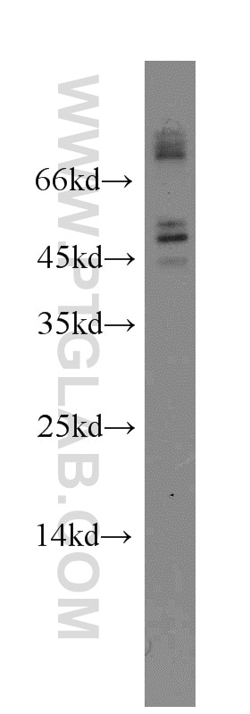 Western Blot (WB) analysis of HEK-293 cells using FOXJ3 Polyclonal antibody (19751-1-AP)