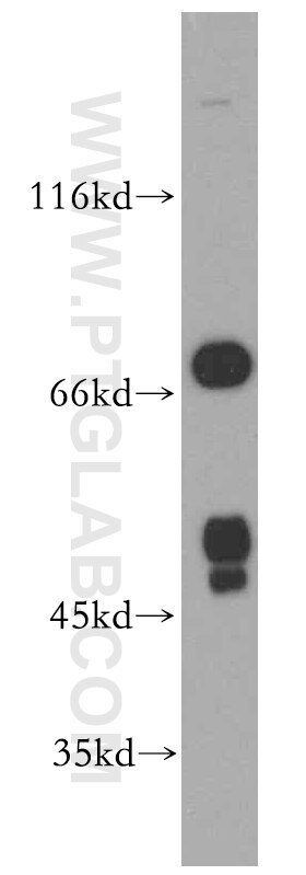 Western Blot (WB) analysis of human liver tissue using FOXJ3 Polyclonal antibody (19751-1-AP)