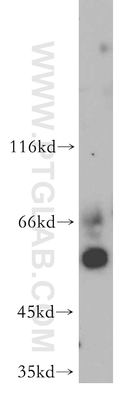 Western Blot (WB) analysis of HepG2 cells using FOXJ3 Polyclonal antibody (21240-1-AP)