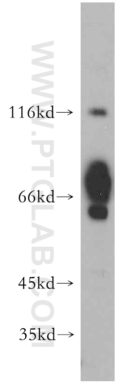 Western Blot (WB) analysis of L02 cells using FOXJ3 Polyclonal antibody (21240-1-AP)