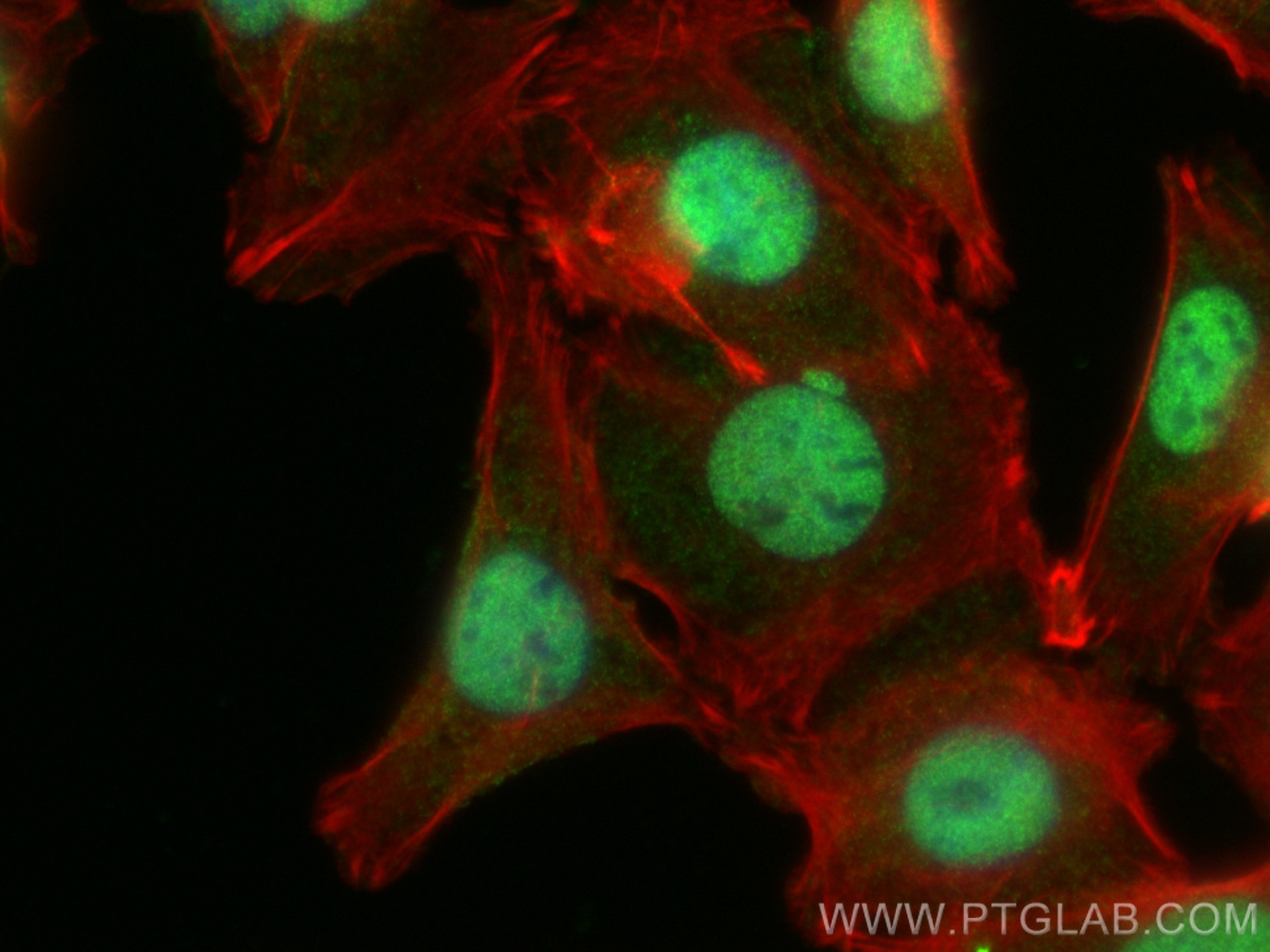 Immunofluorescence (IF) / fluorescent staining of SW480 cells using FOXK1 Polyclonal antibody (29338-1-AP)