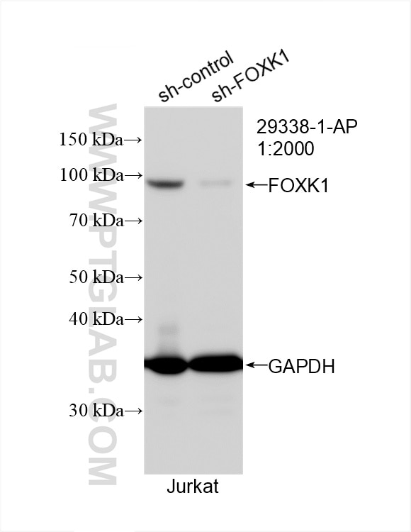 Western Blot (WB) analysis of Jurkat cells using FOXK1 Polyclonal antibody (29338-1-AP)