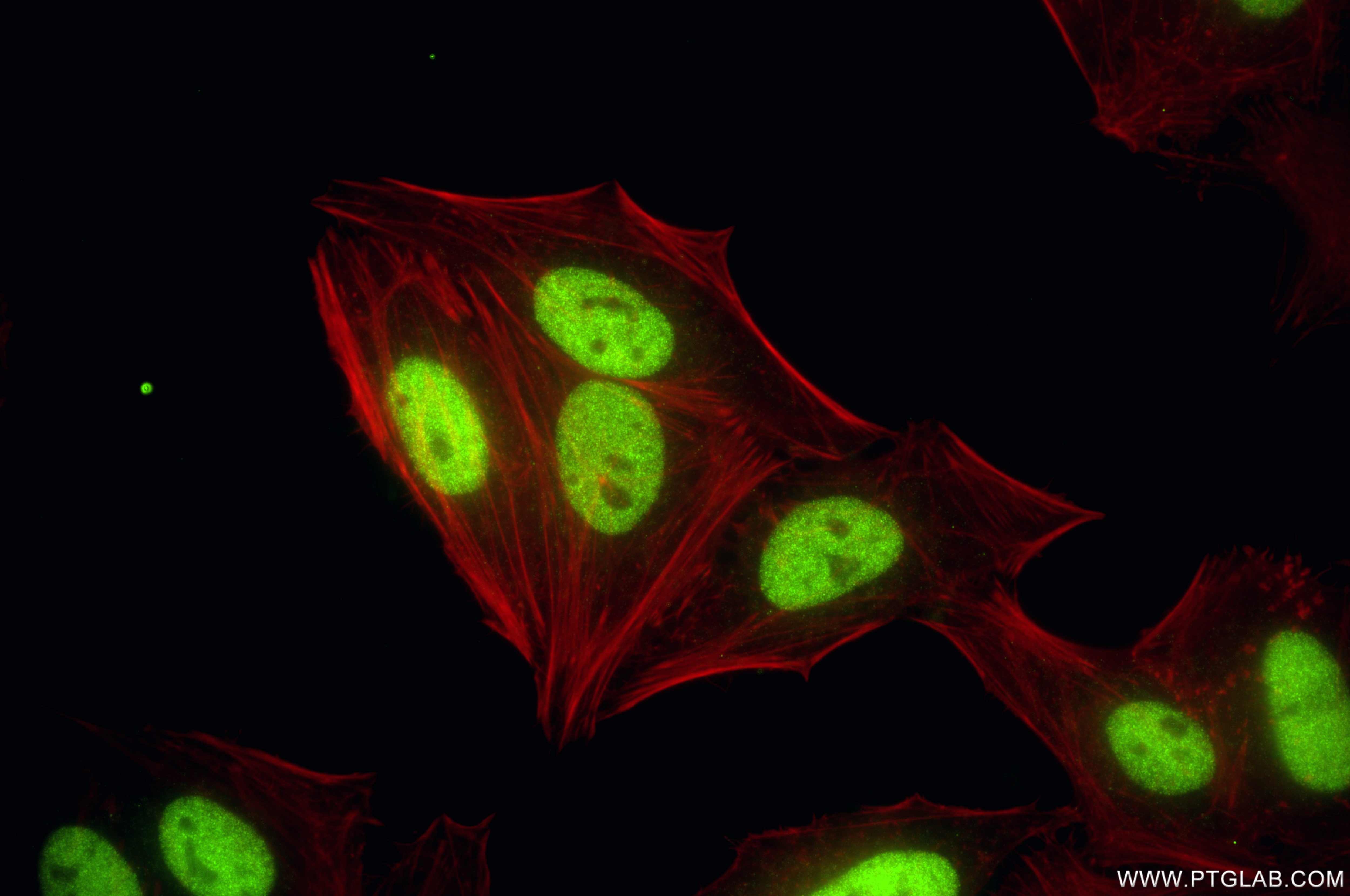 Immunofluorescence (IF) / fluorescent staining of HepG2 cells using FOXK1 Recombinant antibody (86452-1-RR)