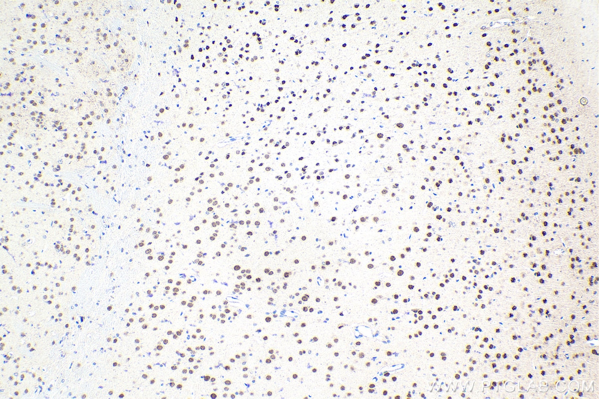 Immunohistochemistry (IHC) staining of mouse brain tissue using FOXK2 Polyclonal antibody (30660-1-AP)